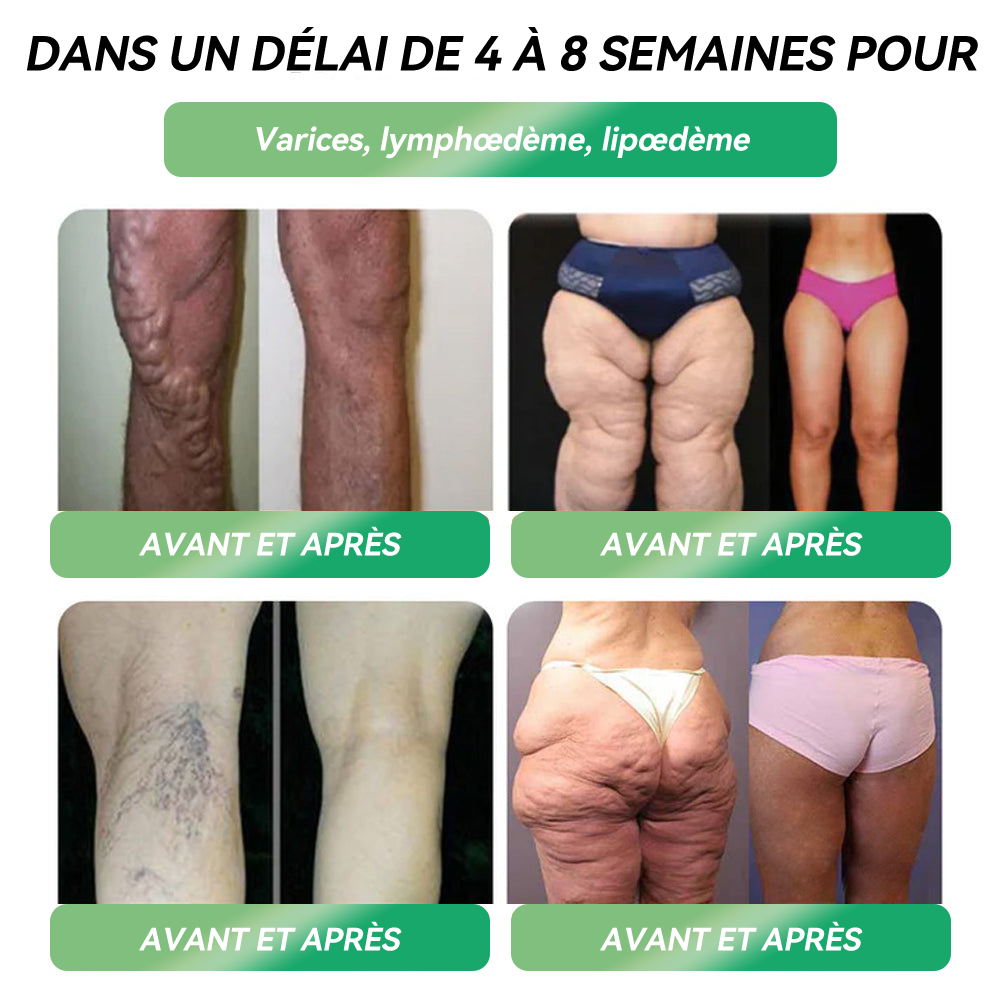 Docteur CA recommandé 👩⚕️|👑 𝖫OTMAY® GLP-1 Multiaction Ampoules Orales(Juste une fois par jour, des changements visibles en 7 jours) Pour l'obésité, la santé cardiovasculaire, le diabète, l'apnée du sommeil, la santé intestinale